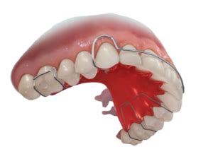 Can a retainer shift teeth back?