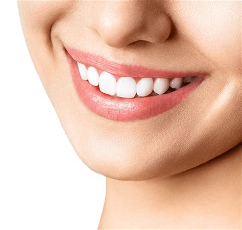 Do teeth still rot under veneers?