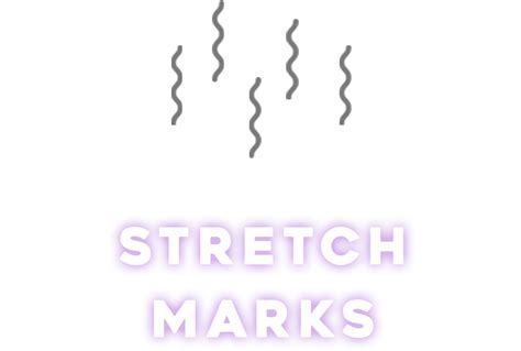 Can Vaseline remove stretch marks?