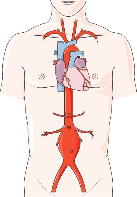 What is aorta clamp used for?