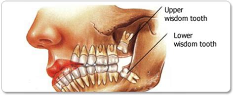 Why Does My Tooth Feel Itchy? - Rewrite The Rules